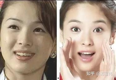 地包天明星有哪些,揭秘娱乐圈中的独特魅力